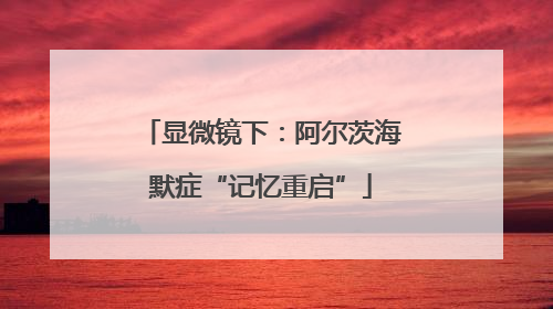 显微镜下：阿尔茨海默症“记忆重启”